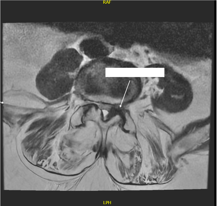 Radiology case #4_2