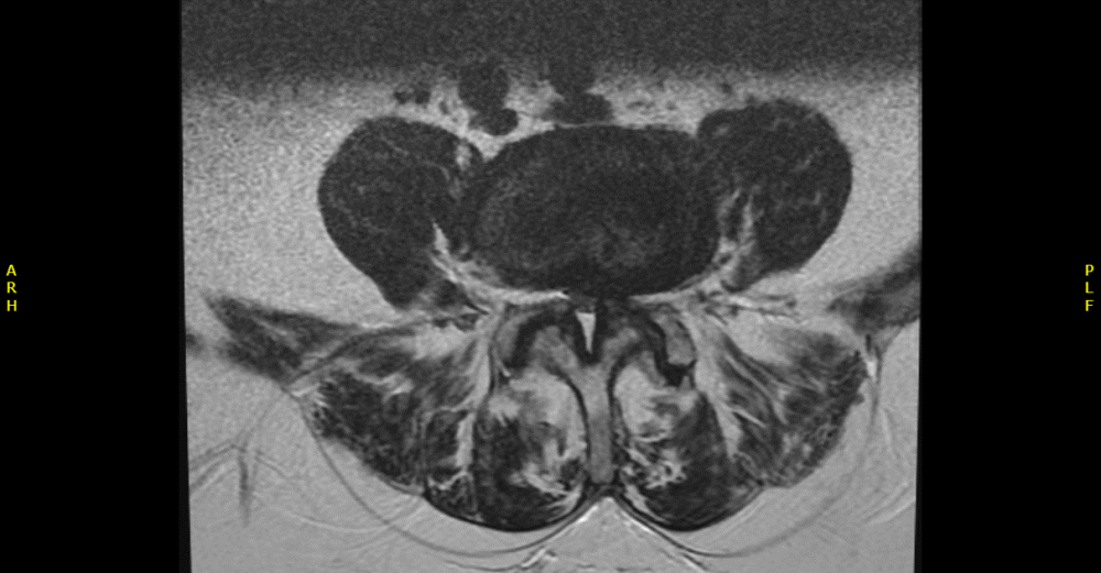 Radiology case #5_2