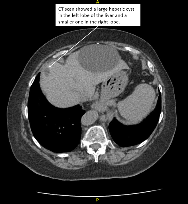 Radiology case #4_8