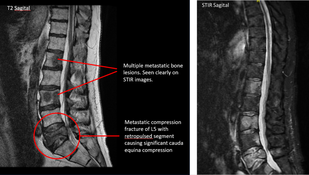 An X Ray image of the patient