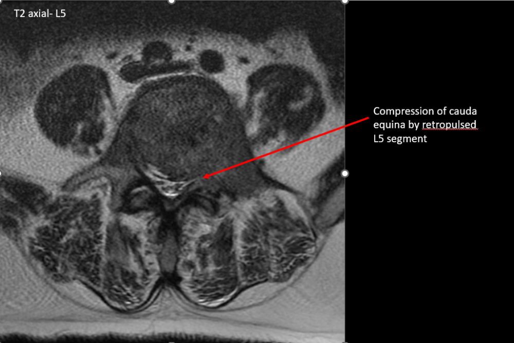 An X Ray image of the patient